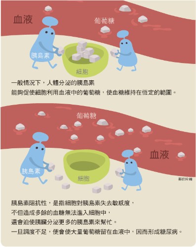 糖尿病-胰島素抗性-血糖