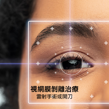 視網膜剝離治療