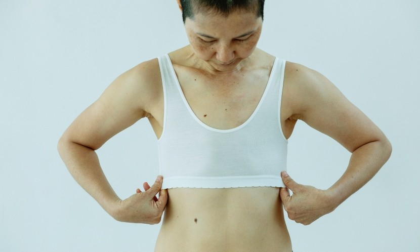 你的痣帶財？還是帶癌？
