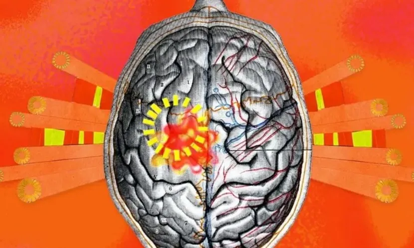 愈熱愈傷腦！醫師示警：高溫導致中風死亡恐年增萬人