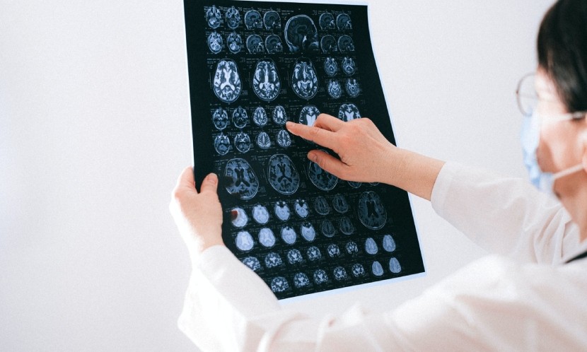 頭部外傷後之延遲性腦出血──淺談慢性硬腦膜下腔出血