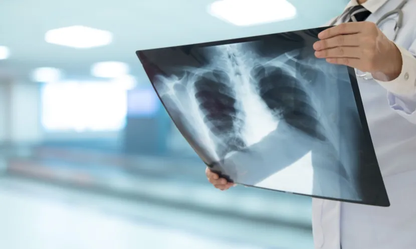 醫師表示,若是急性肺部感染影響肺功能,但如果病人原本健康狀況良好,仍建議積極插管治療,有機會痊癒回到正常生活。圖片來源 / Shutterstock
