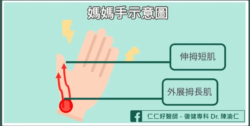 媽媽手