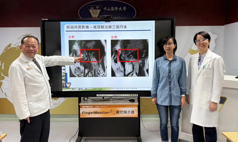 曾小姐(右2)因顳顎關節障礙,歷經半年的痛苦,終於在中山附醫團隊的治療下有了改善。 圖片來源 / 中山醫學大學附設醫院提供