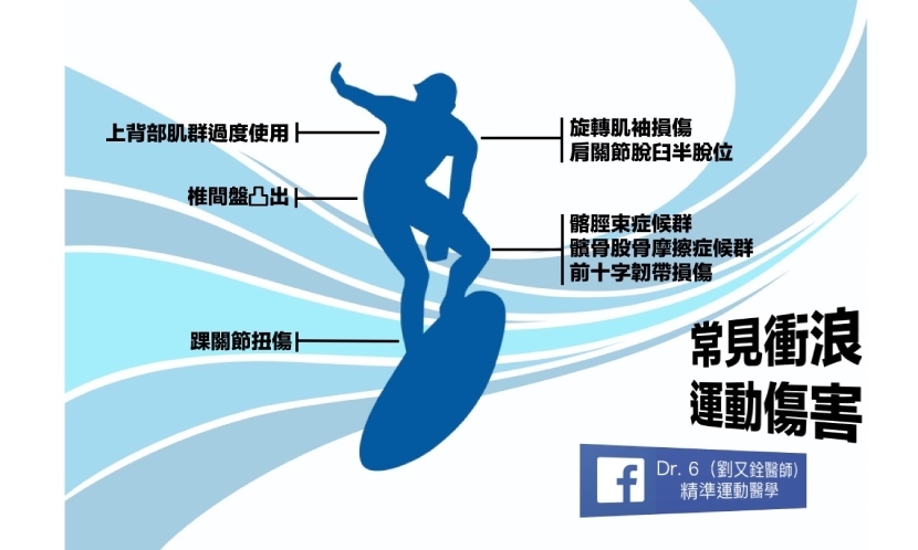 衝浪 運動傷害 肩胛 核心肌群 椎間盤 膝蓋