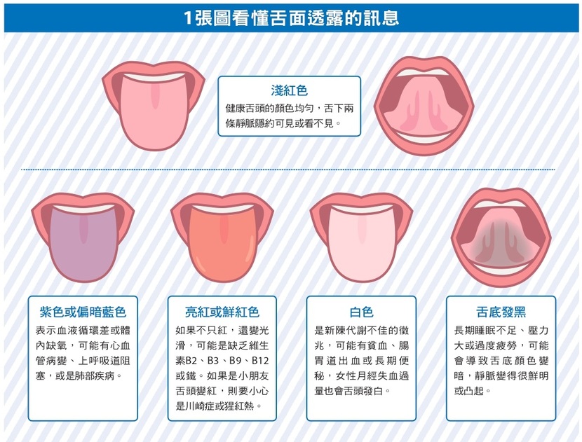 舌頭 顏色 舌面 透視鏡 淺紅色 肺部疾病