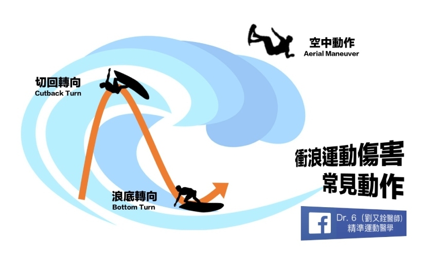 衝浪 運動傷害 肩胛 核心肌群 椎間盤 膝蓋