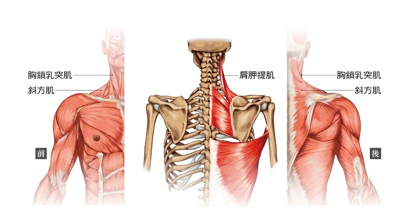 脖子歪 斜方肌 提肩胛肌 胸所乳突肌 斜頸症 拉傷