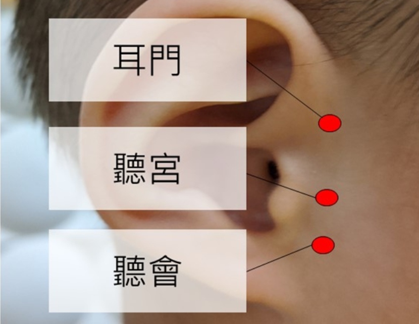 兒童 腺樣體腫大 鼻咽 發炎 鼻涕 鼻塞