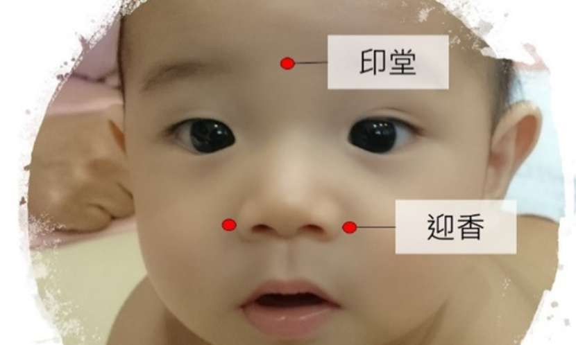 兒童 腺樣體腫大 鼻咽 發炎 鼻涕 鼻塞