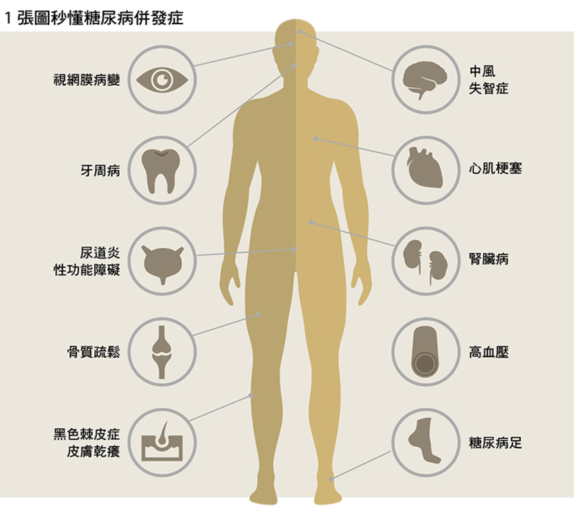 糖尿病-糖尿病併發症-糖尿病血糖-糖尿病原因-糖尿病症狀