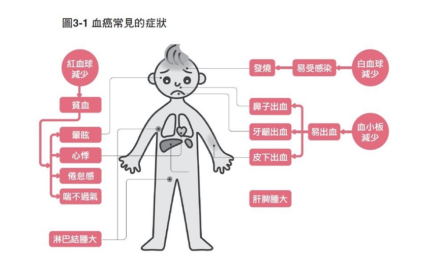 血癌-症狀-血癌是什麼-紅血球-白血球