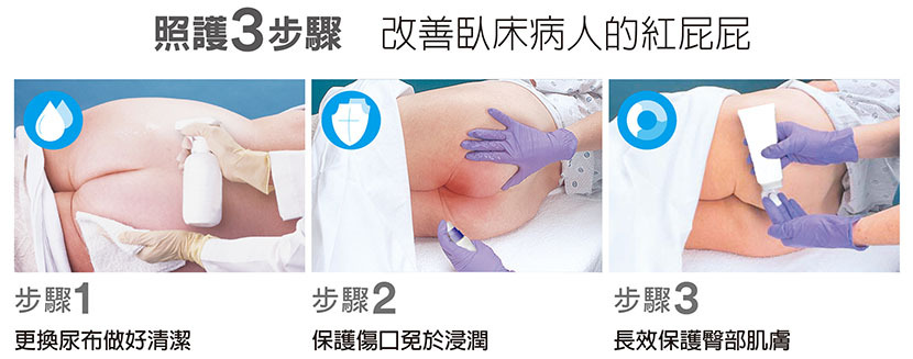 失禁性皮膚炎照護3步驟