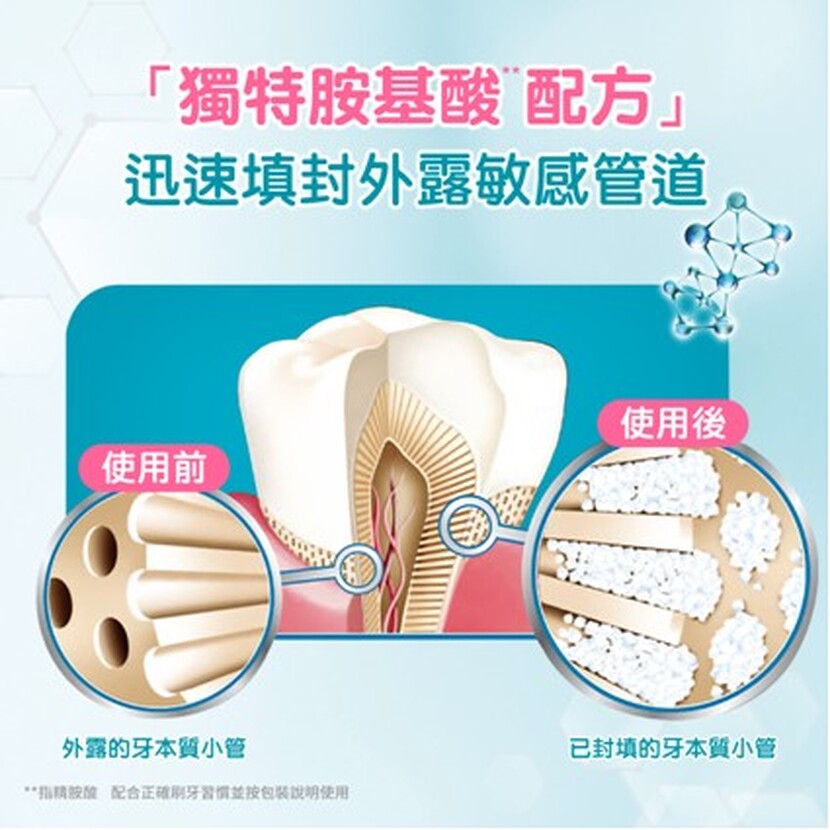 牙齒酸痛, 牙齒酸軟痛, 酸酸的, 怎麼辦, 無力, 的原因, 緩解, 咬東西, 如何治療, 酸酸痛痛, 突然, 止痛, 怎麼治療, 敏感性牙齒,高露潔,Colgate