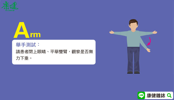 A(arm): 請他閉上眼睛伸出雙手10秒鐘,如果其中一隻手臂掉下來,表示有問題。