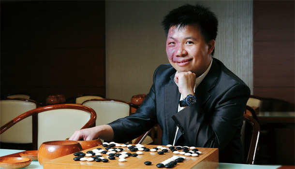 針灸,讓我放鬆棋盤上的自己