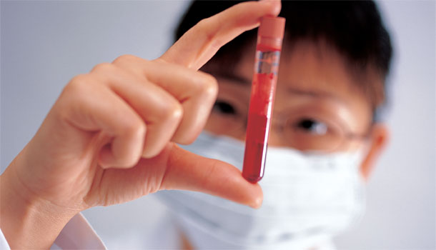 聰明使用抗凝血劑華法林