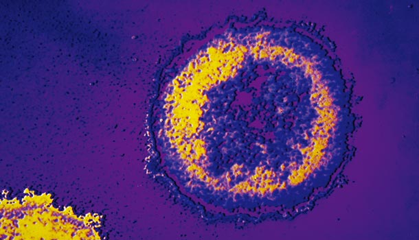 HIV病毒小檔案