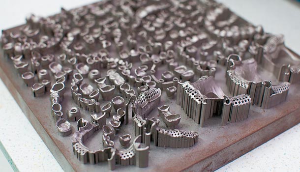 假牙製作新幫手:3D列印技術