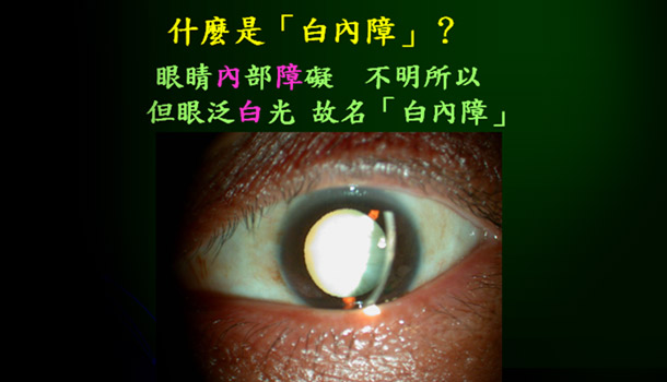 陳瑩山:小心!重度手遊會讓眼睛未老先衰