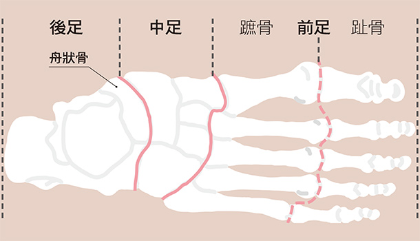 腳好痛!腳痛及變形原因大不同