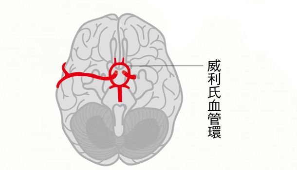 洪蘭:健檢發現顱內動脈瘤,怎麼辦?