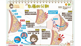 【圖解】乳癌分期這樣看