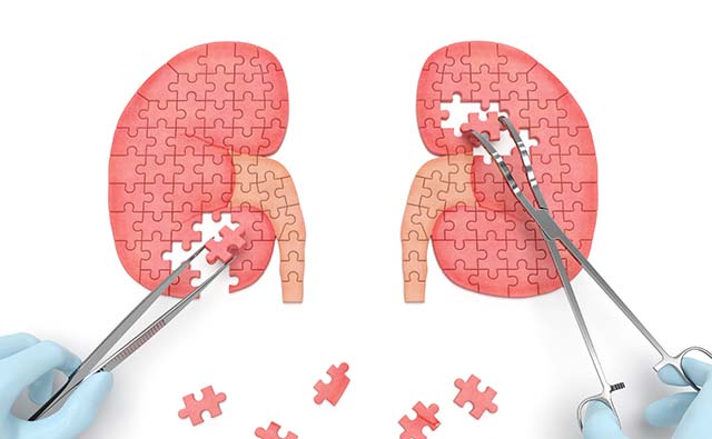 抗老先「愛腎」，活力不斷電！立即破除補腎迷思